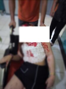 Dianiaya Di Tempat Karaoke, Seorang Pemandu Lagu di Rimbo Bujang Di larikan ke Puskesmas