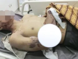 Polisi Tegaskan Kematian Pemuda di Jalinsum Bungo Masih Diselidiki, Belum Ada Bukti Korban Begal